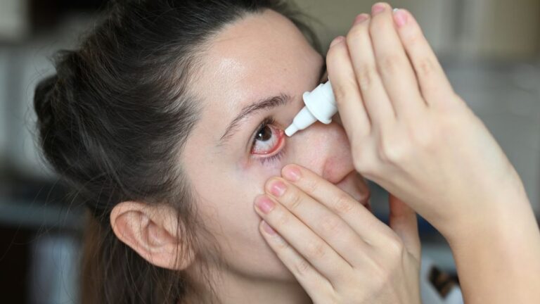 eye-health-4-ways-to-treat-eye-redness-at-home-and-keep-them-healthy