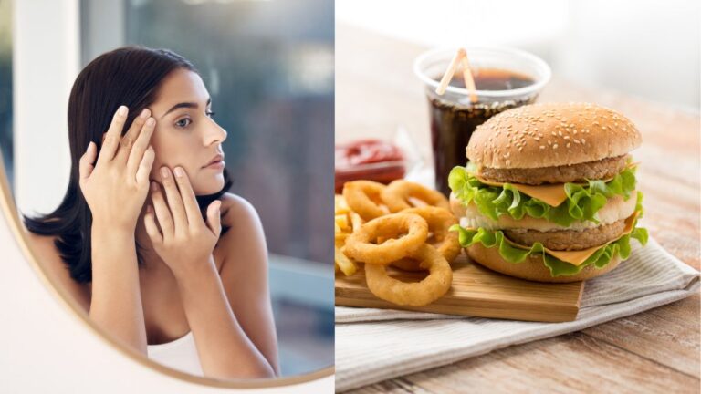 summer-diet-foods-that-you-must-avoid-to-protect-your-skin-from-breakouts