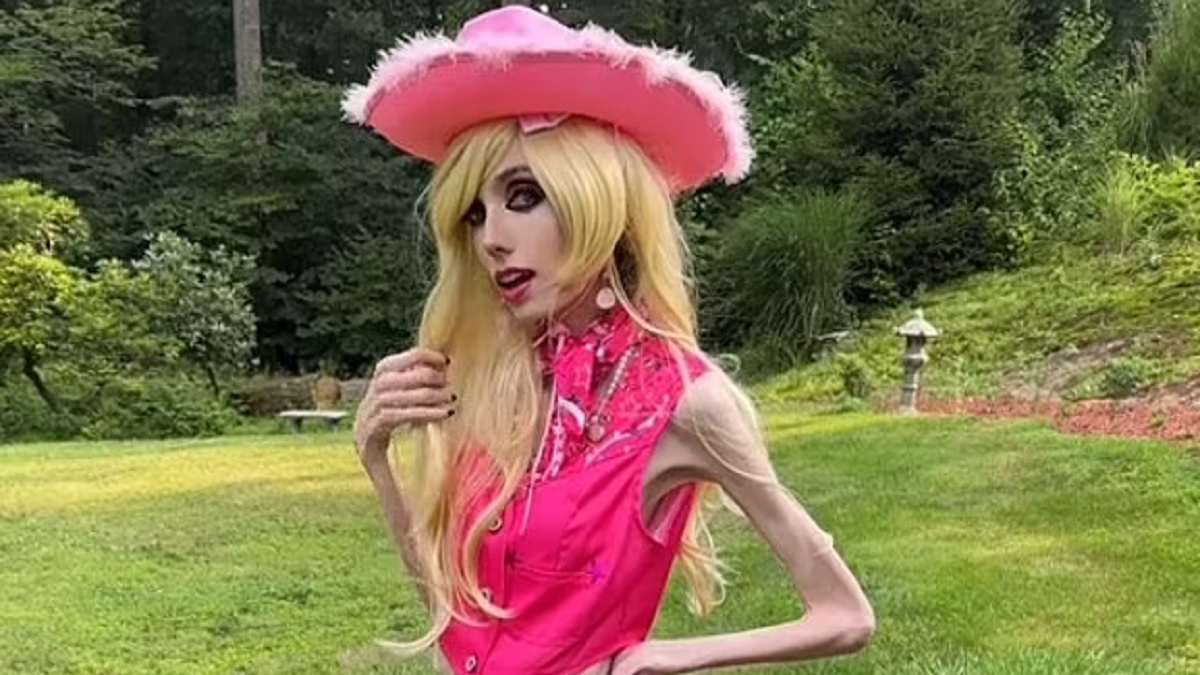 Anorexic YouTuber Eugenia Cooney, 29, new video sparks outrage over eating disorder battle