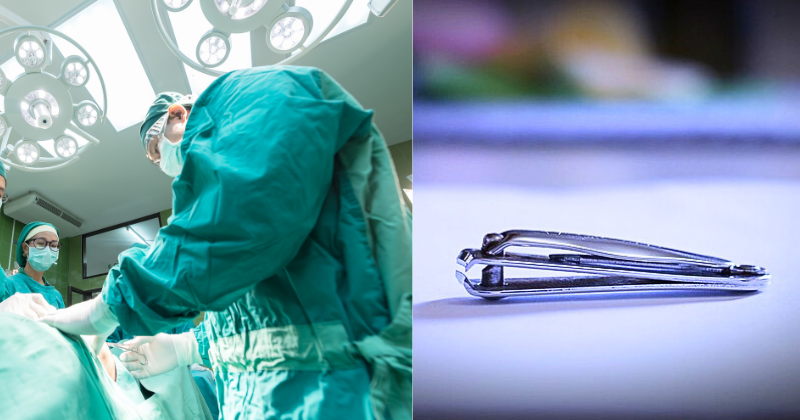 Long-Awaited Relief: Nail Cutter Removed From Bengaluru Man's Stomach After Eight Years