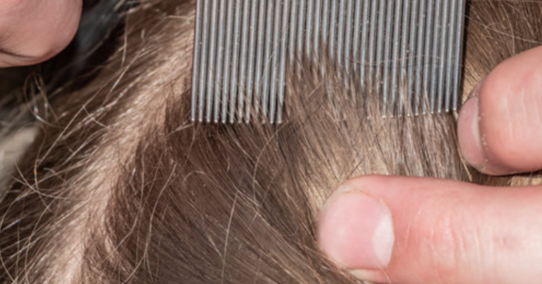 Mother Refuses To Kill Daughter's Head Lice Because She's 'Vegan'