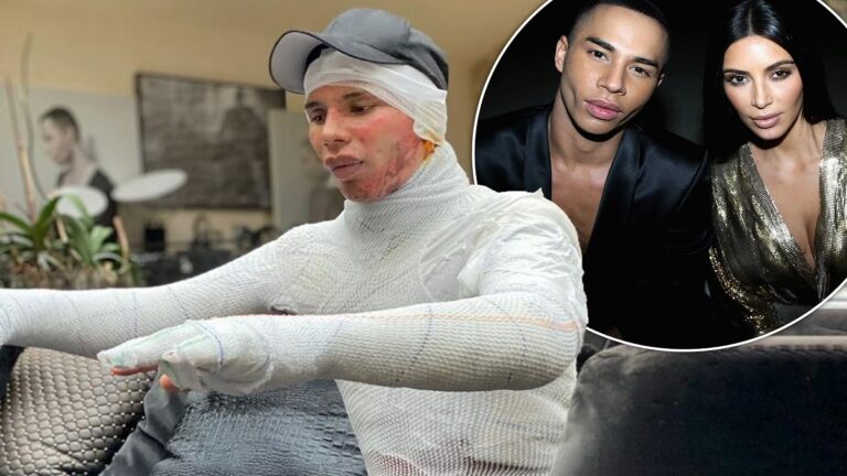 Olivier Rousteing Burns Accident: When did Olivier Rousteing get burned?