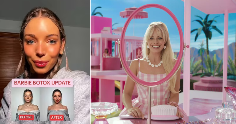 Barbie Botox Trend Is On The Rise: Eager Clients Flock To Clinics To Don Margot Robbie's Magical Look