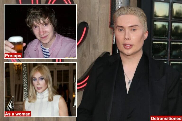 Former trans influencer Oli London regrets his 32 cosmetic surgeries in 10 years