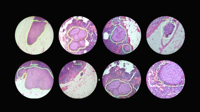 Google is developing a microscope powered by artificial intelligence: it could be a game-changer for cancer detection