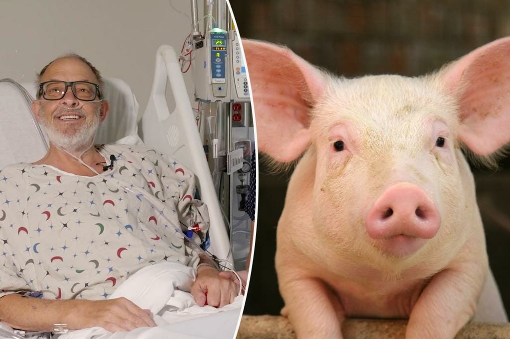 The second pig heart transplant saves a dying man: "Now I have hope"