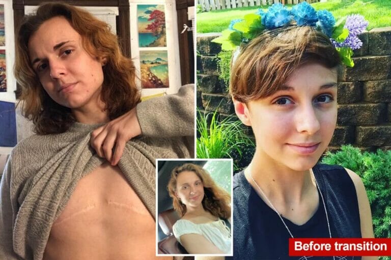 Woman who transitioned to male at age 16 during ‘chaotic time’ sues doctors who performed double mastectomy