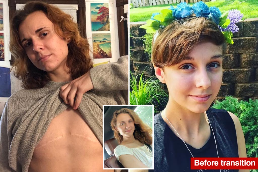 Woman who transitioned to male at age 16 during 'chaotic time' sues doctors who performed double mastectomy