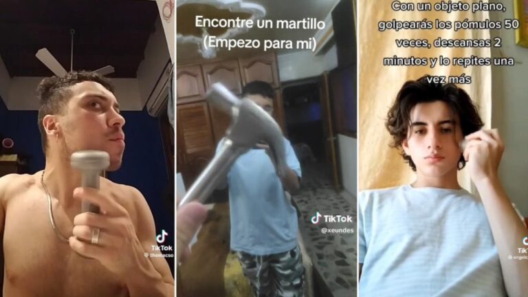 ‘Bone smashing’: the dangerous viral TikTok challenge that puts health at risk