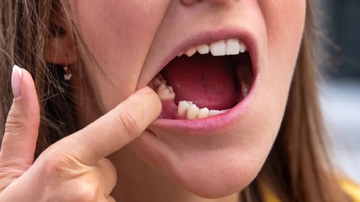 Clinical trials to grow teeth: The world's first drug to grow teeth enters clinical trials