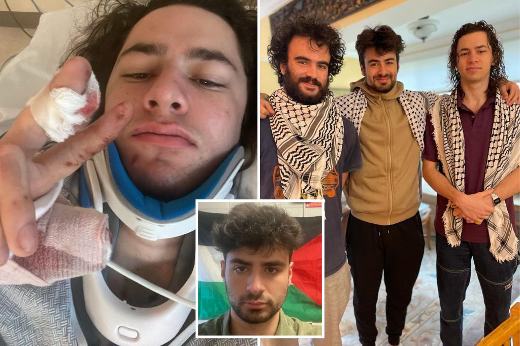 Three Palestinian college students shot in Vermont in alleged partial attack: 'Another example of how hate turns violent'