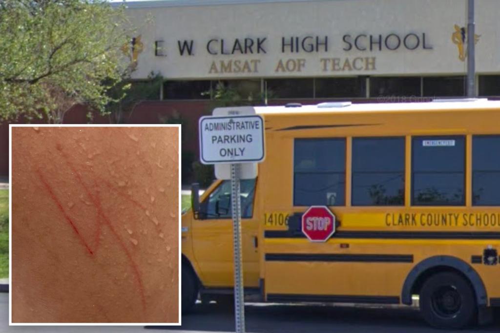 Family of autistic Jewish teen whose classmates carved swastika into his back sues school