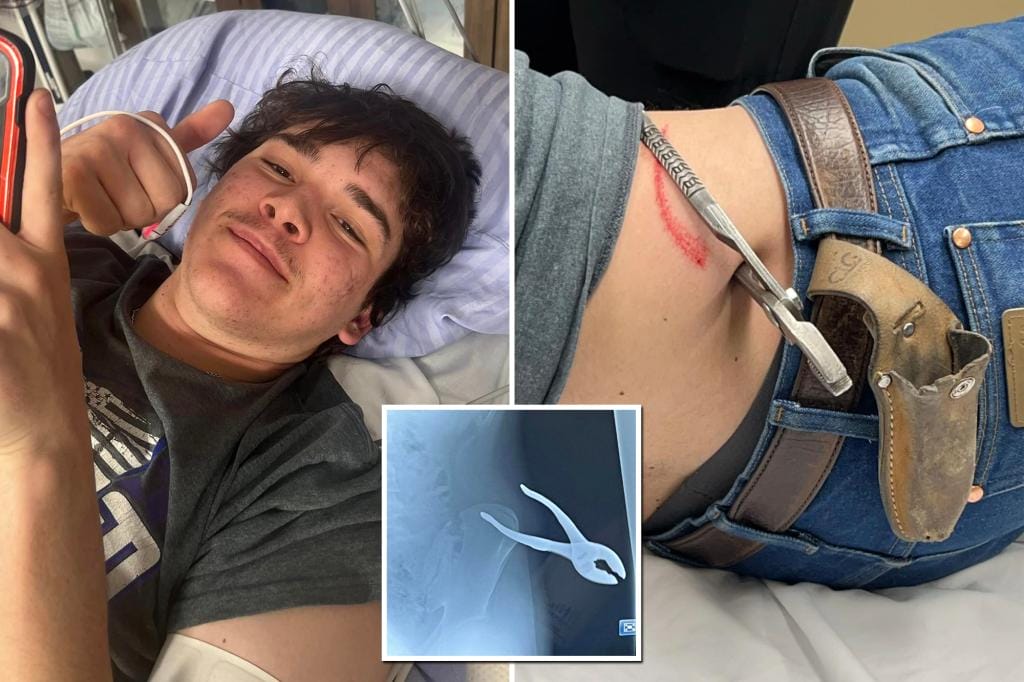 Teenager impaled by own pliers after slipping on ice in gruesome 'freak accident': 'Something I've never seen before'